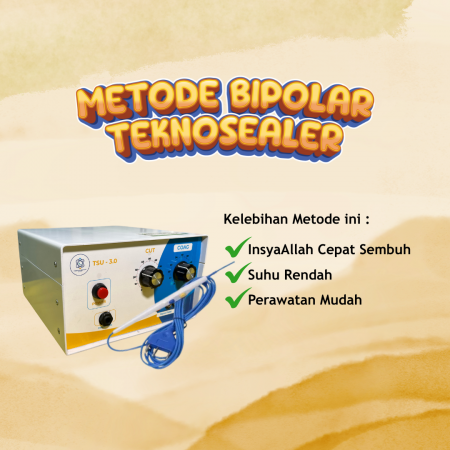 METODE PALING MODERN